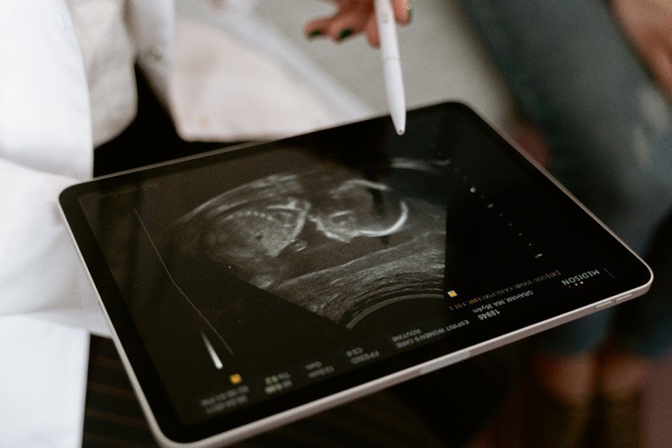 an ultrasound scan on a tablet